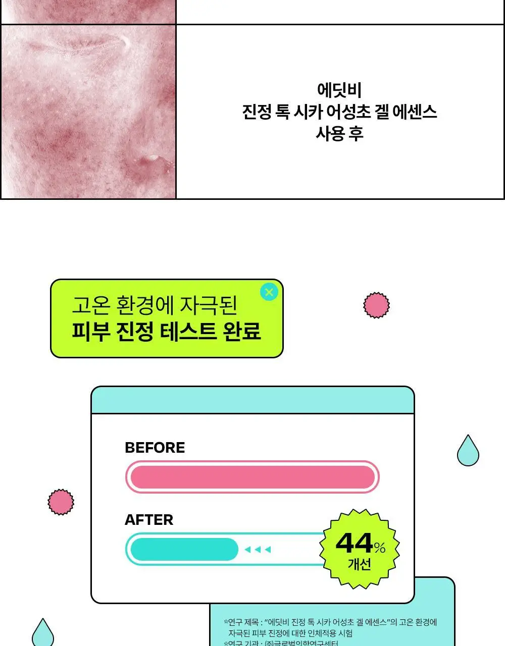 [붉은피부진정/겉속보습] 에딧비 진정 톡 시카 어성초 겔 에센스 200ml 상세페이지 13
